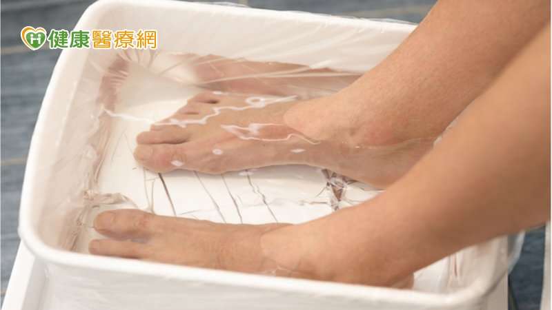 香港腳泡熱水、擦凡士林能緩解？　皮膚科醫師破解迷思