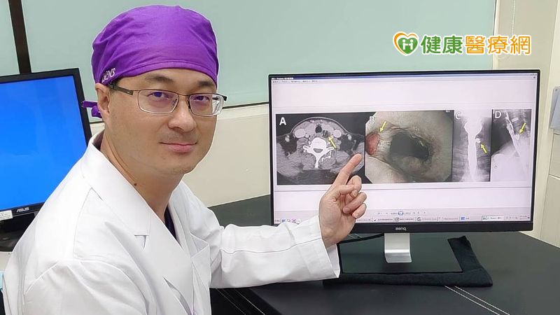 進行食道憩室或甲狀腺切除手術時，建議搭配返喉神經監測儀，保留返喉神經功能，避免傷及神經。