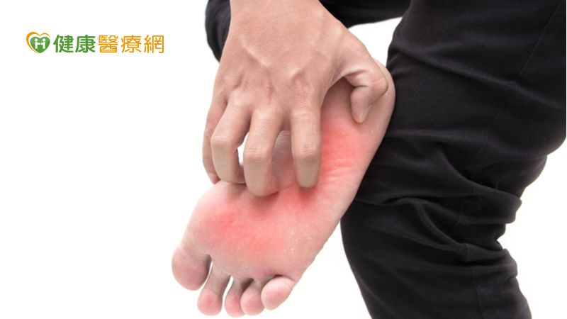腳癢有可能是香港腳也可能是汗皰疹。