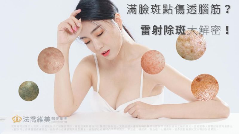 透過現代醫美的技術，雷射除斑已是非常普遍的療程之一