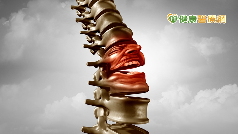 中軸性脊椎關節炎患者憑感覺停藥？　恐致脊椎沾黏不復返