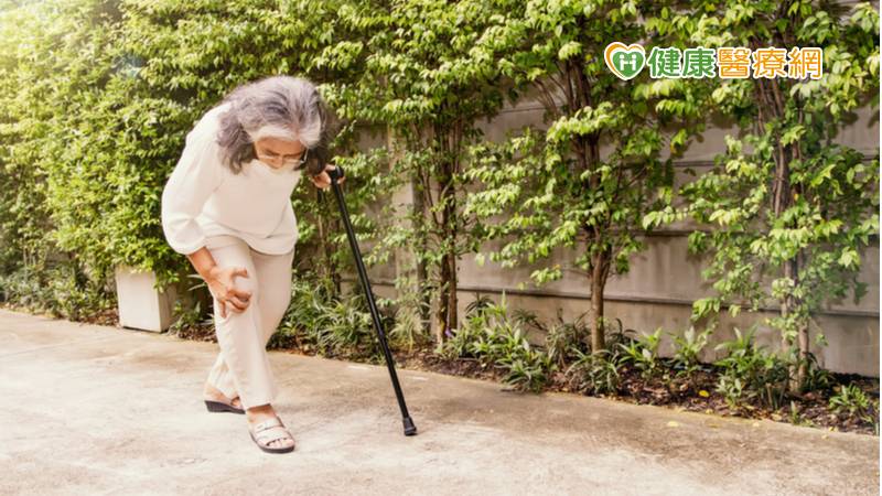 67歲鄭阿姨多年來飽受右膝疼痛所苦，軟骨嚴重磨損已到需置換人工關節程度，且還是罕見的膝外翻變形而不是常見的O型腿，膝外翻角度高達35度，因手術難度高讓鄭阿姨再三猶豫，所幸經醫師建議接受「微創人工膝關節置換手術」，術後至今恢復良好。