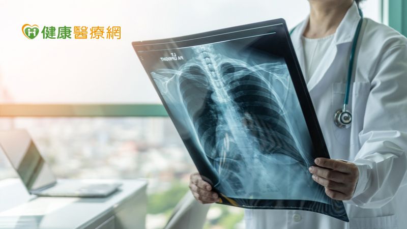 莫名喘咳竟是晚期小細胞肺癌　免疫組合治療燃生機