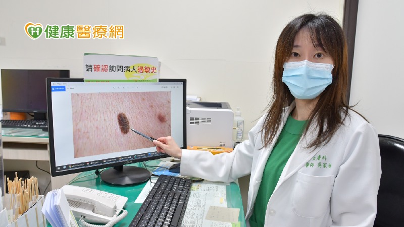 吳家華主任表示，由於雷射後仍需做皮膚護理，建議民眾可在乾燥且不易出汗的冬季進行手術（圖為凸起的脂漏性角化斑）