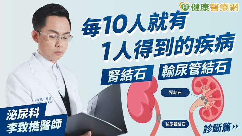 花生粒大的「腎結石」險要命　醫：恐有年輕化趨勢 