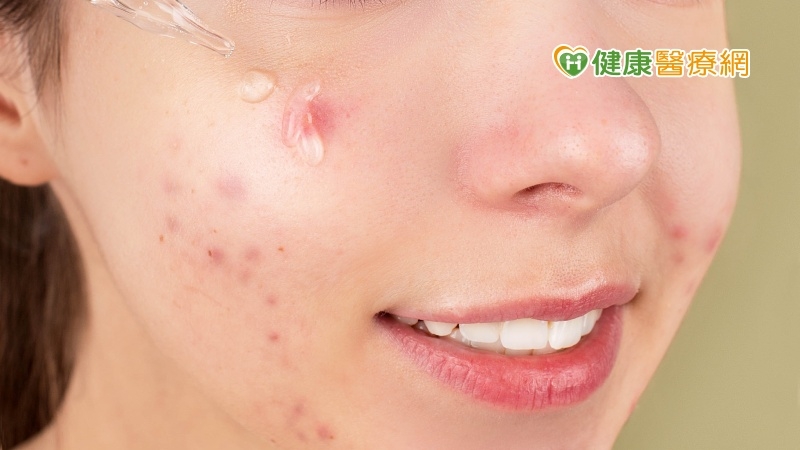 食藥署也提醒，雖然杜鵑花酸可於白天塗抹，但也別忘了，搭配防曬一同輔助，才能給肌膚更好的防護！