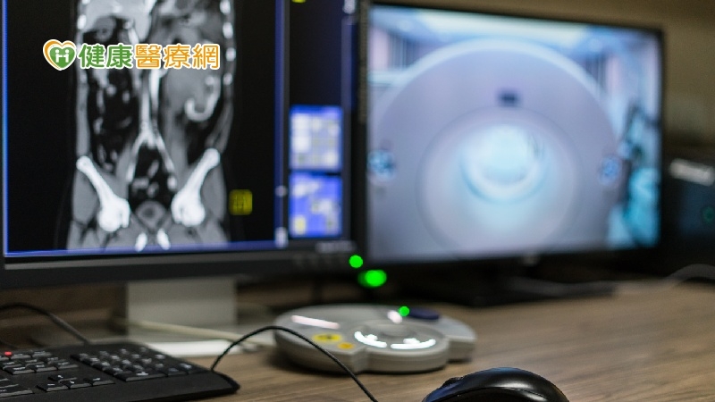 陳柏如外科主治醫師建議高危險族群，接受低劑量肺部電腦斷層掃描的健康檢查。