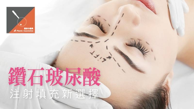 永恆之星鑽石玻尿酸採用獨特的3H璀璨交聯技術™，讓玻尿酸兼具柔軟與彈性，不僅方便醫師施打，且塑形度高，也能維持立體不易變形或坍塌。