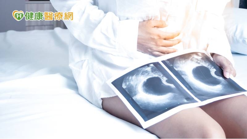 卵巢腫瘤危險因子為：肥胖者、初經年齡較早者、不孕症患者、有家族史者等。