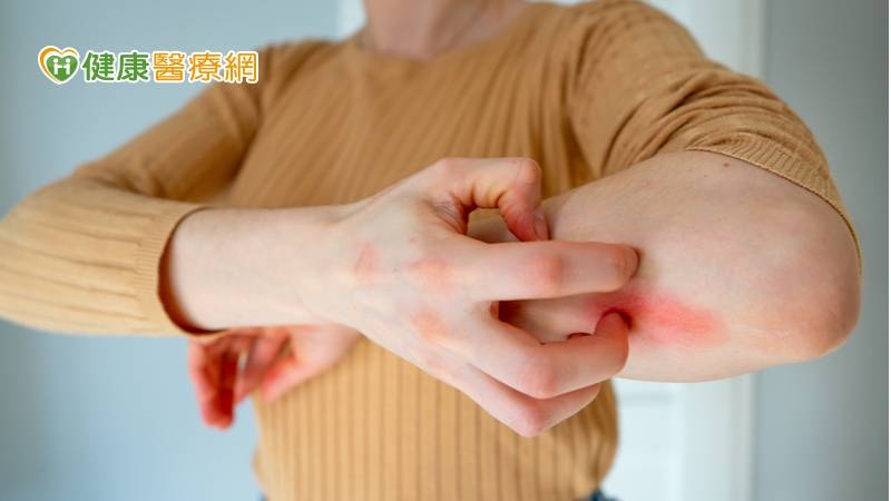 異位性皮膚炎的病理機轉牽涉到多樣的因素，包含基因、環境，還有免疫系統的失調。