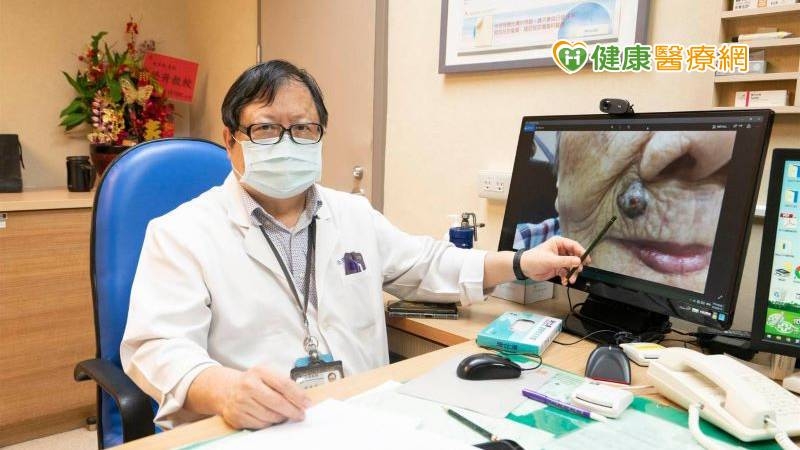 在台灣多數惡性黑色素細胞瘤病人被診斷確定時，均屬於疾病晚期，常合併有局部皮膚轉移或淋巴轉移。