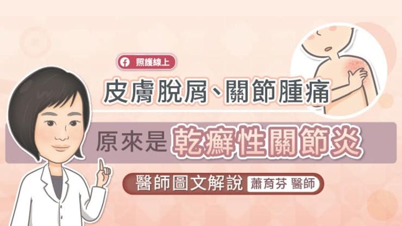 蕭育芬醫師說，乾癬性關節炎多數發病在30~50 歲的青壯男女，初期開始可能只有乾癬，而乾癬會造成皮膚紅疹脫屑搔癢，嚴重影響患者外觀。