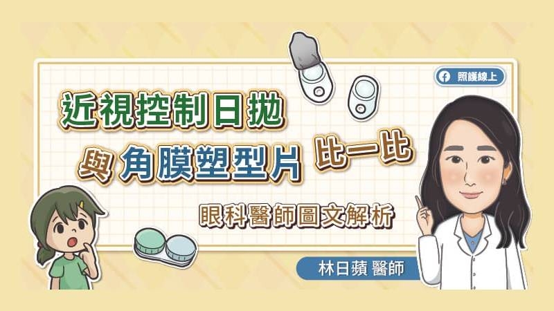 近視控制專用日拋與角膜塑型片有許多不同，首先是配戴時間，前者為白天配戴10-15小時，晚上取下；後者則是睡覺時配戴，需戴滿6-8小時，早上起床後再卸除。