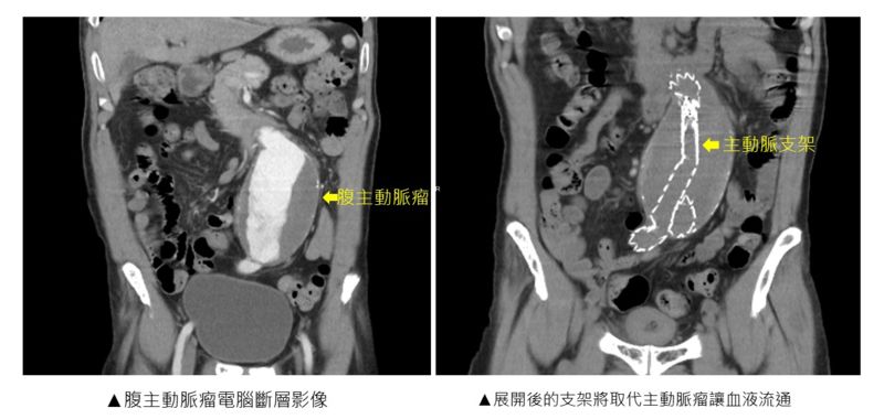 （圖／翻攝自健康醫療網）