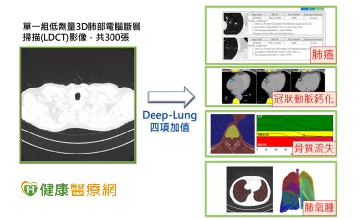 北醫大副校長陳震宇研究團隊,研發「Deep-Lung 人工智慧多模影像精準健康平臺」,一張電腦斷層影像就可預測4種疾病,是全球首創。