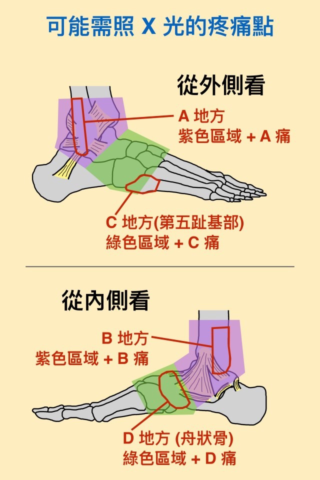 疼痛點