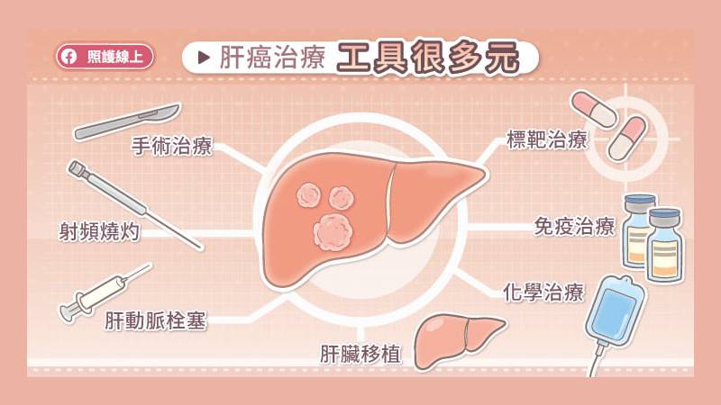 肝癌的治療工具相當多元