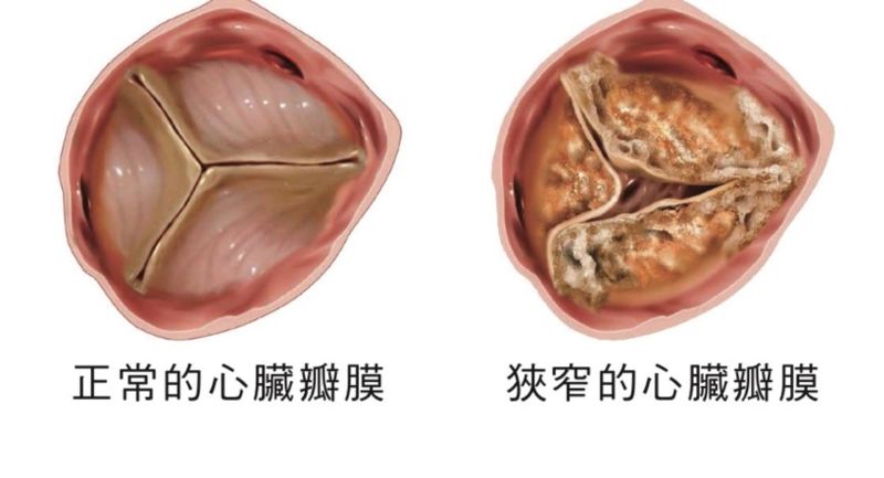 （圖／健康醫療網提供）