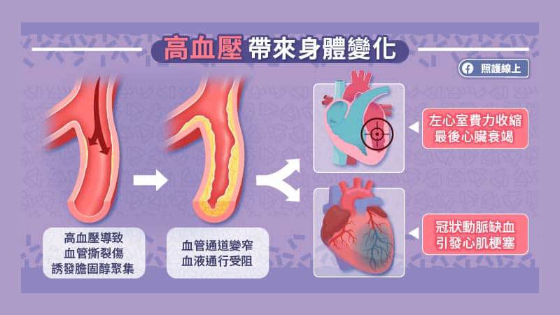 高血壓帶來的身體變化