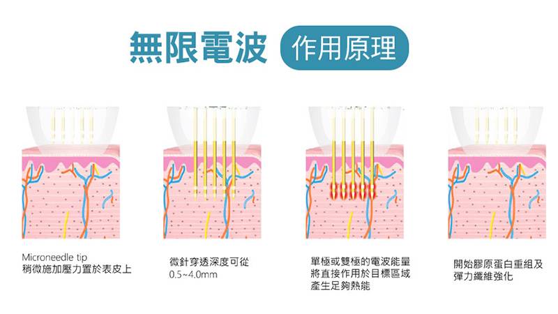 無限電波作用原理