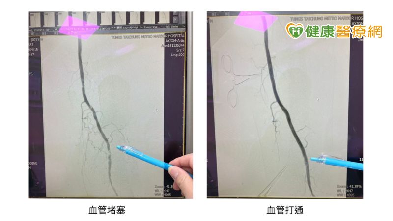 （圖／健康醫療網提供）