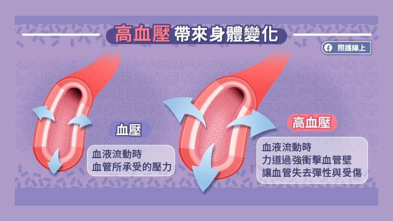 高血壓帶來的身體變化