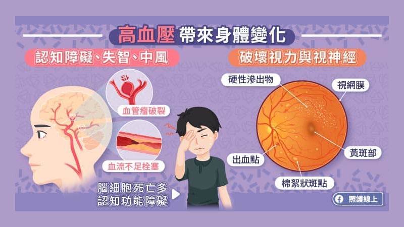 高血壓帶來的身體變化