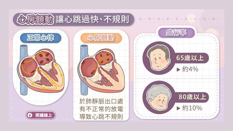 心跳過快、不規則，當心心房顫動