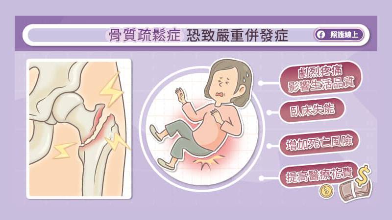 骨質疏鬆症恐致嚴重併發症