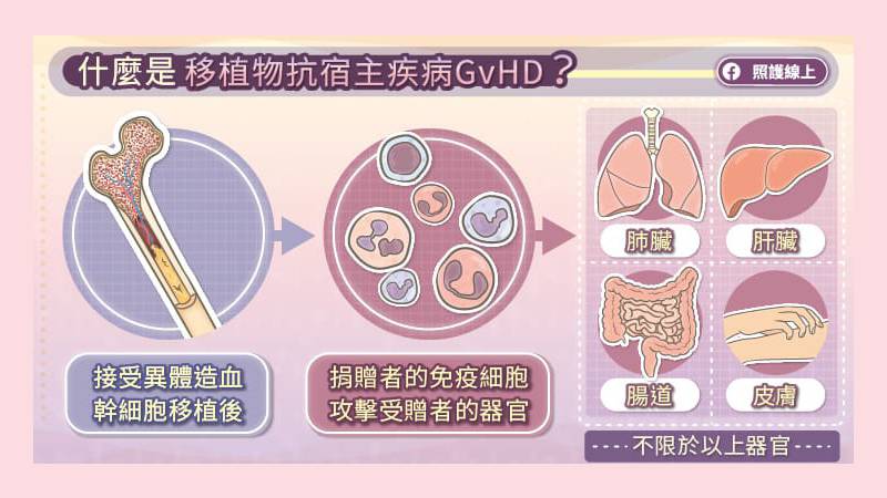 什麼是移植物抗宿主疾病GvHD