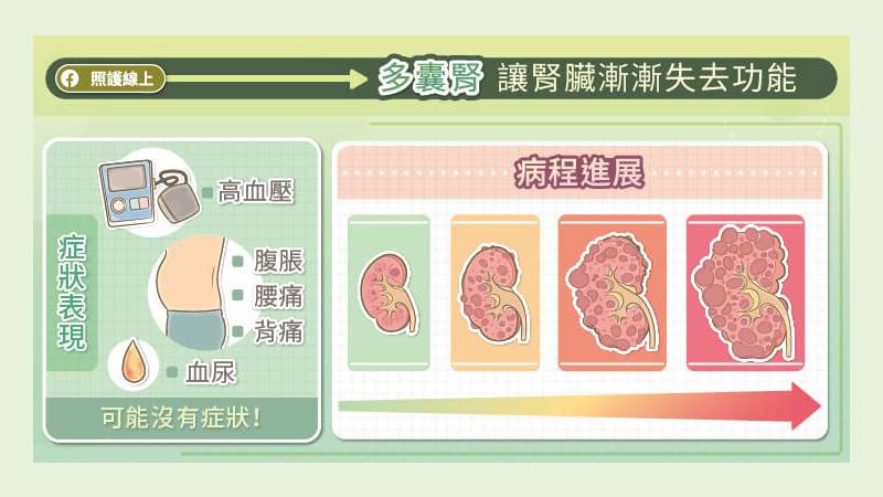 多囊腎會造成許多問題