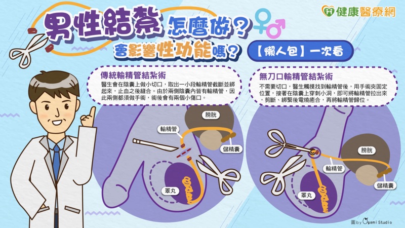 結紮手術兩種類型比一比