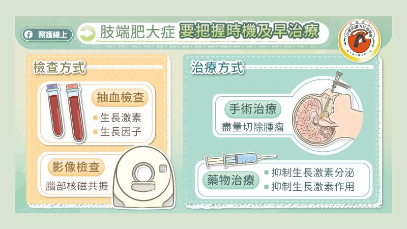 肢端肥大症把握時機盡早治療