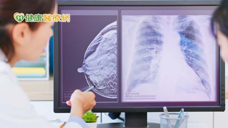 一次看！乳房X光攝影流程4步驟、異常結果處理指引　3異狀應盡