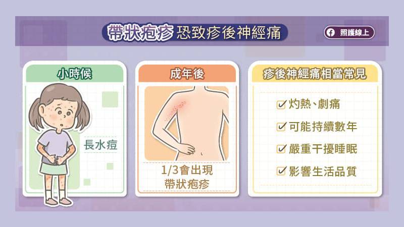 帶狀疱疹診後神經痛