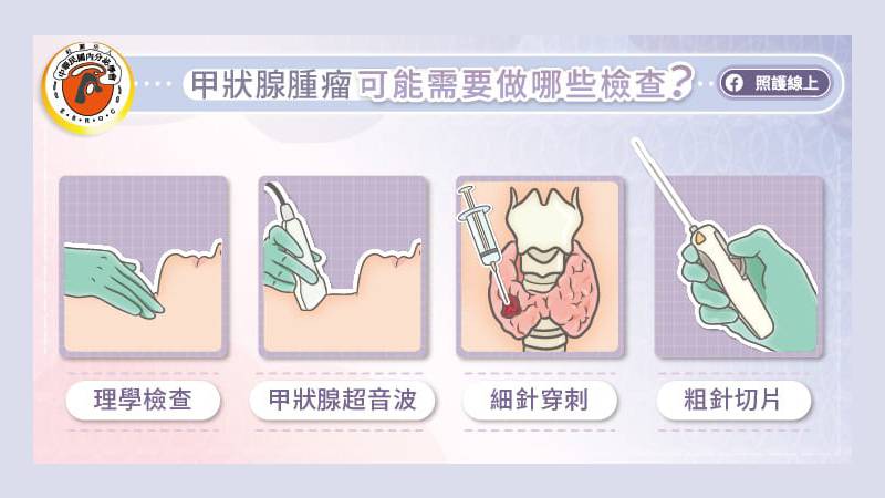 甲狀腺癌需要做哪些檢查