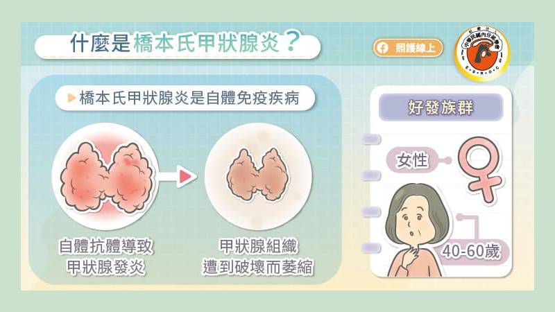 什麼是橋本氏甲狀腺炎?