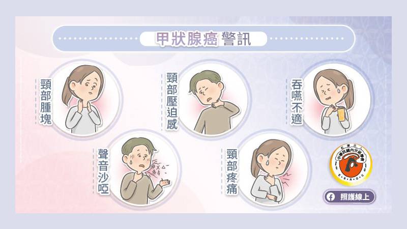 甲狀腺癌警訊