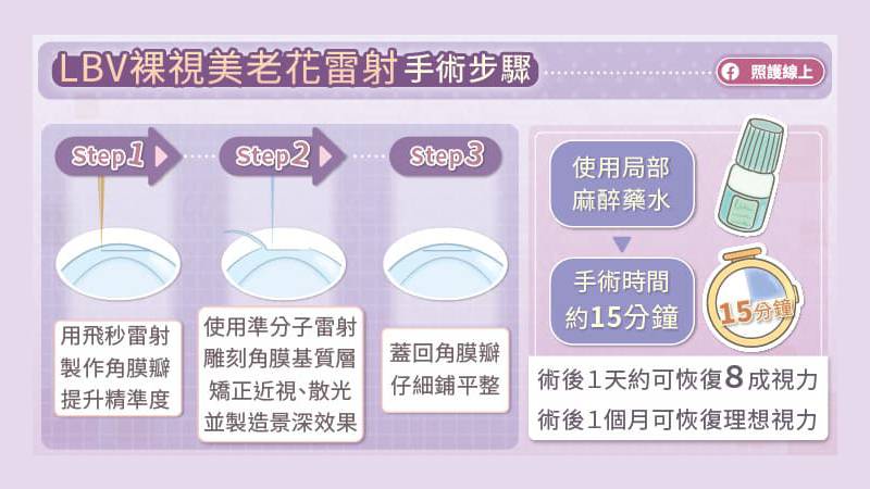 LBV裸視美老花雷射手術步驟