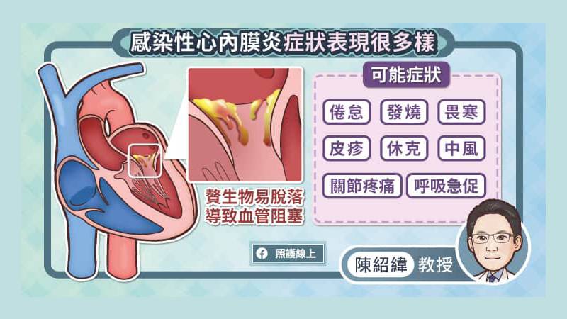 感染性心內膜炎的症狀非常多樣