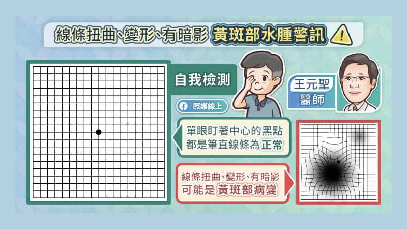 線條、扭曲、變形有暗影 黃斑部水腫警訊