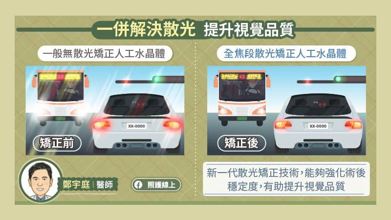 一併解決散光 提升視覺品質