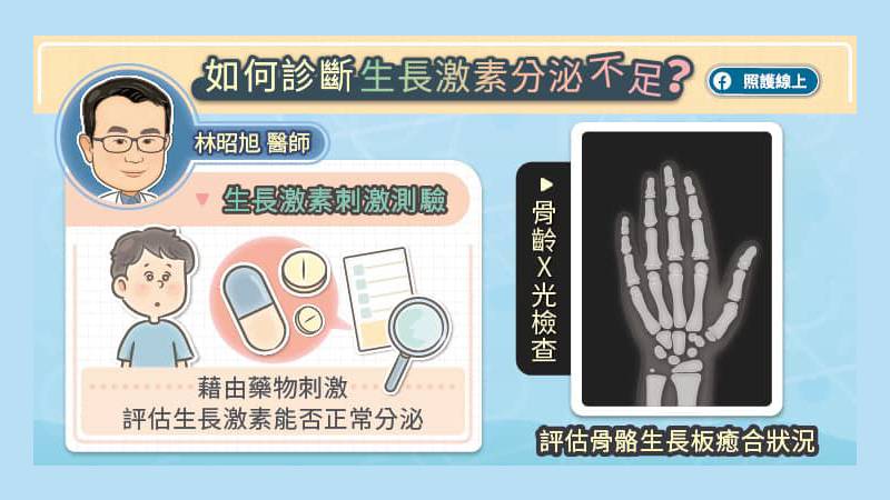 如何診斷生長激素缺乏？