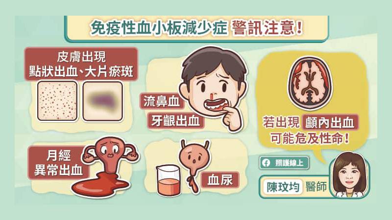 免疫性血小板減少症警訊注意