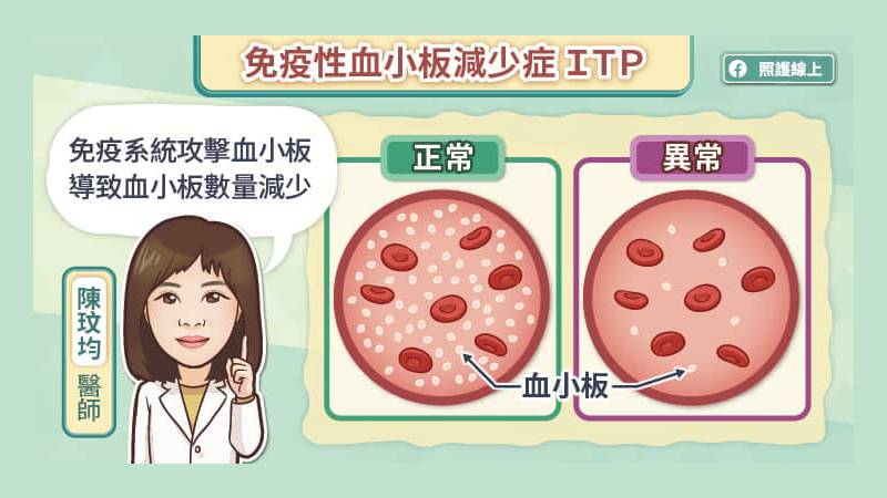 免疫性血小板減少症ITP