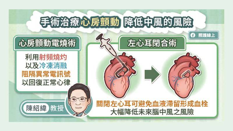手術治療心房顫動 降低中風風險