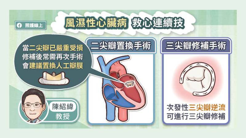 風濕性心臟病 救心連續技