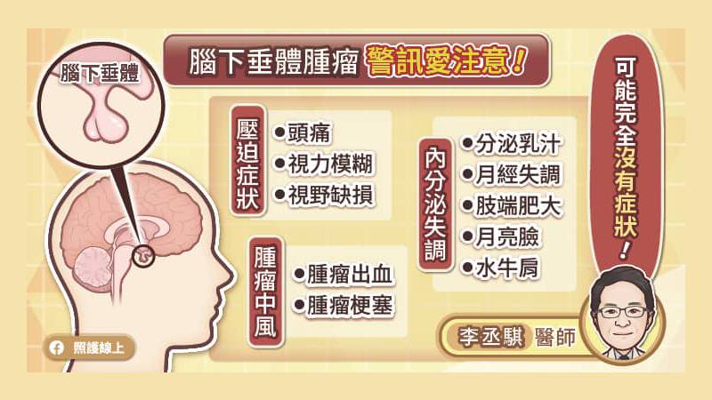 腦下垂體腫瘤警訊注意