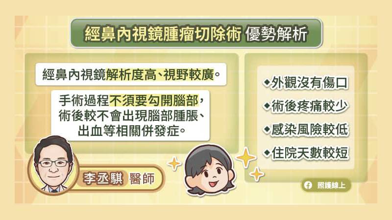 經鼻內視鏡切除手術優勢解析