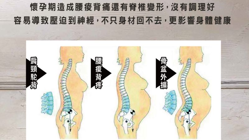 產後如何恢復身材？醫：這幾招找回完美體態_圖2